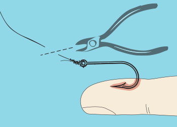 cutting fish hooks How To Remove A Fish Hook
